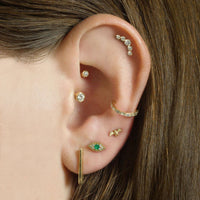 Ear Curation Consultation